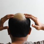 Skala mimpi – The Hindu